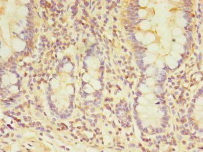 TARS2 Antibody