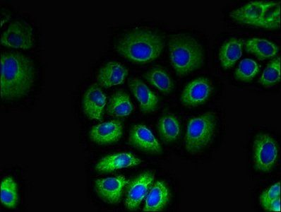 TAS1R2 Antibody