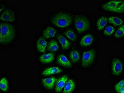 TAS1R2 antibody