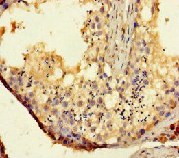 TAS2R14 antibody