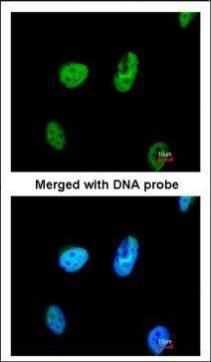 TATDN1 antibody