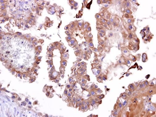 TATDN1 Rabbit Polyclonal Antibody