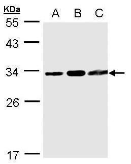 TATDN1 Rabbit Polyclonal Antibody