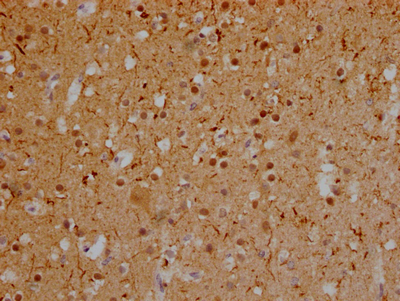 MAPT Recombinant Monoclonal Antibody