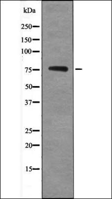 Tau (Phospho-Ser717/400) antibody