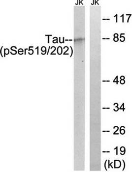 Tau (phospho-Ser519/202) antibody