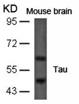Tau (Ab-396) Antibody