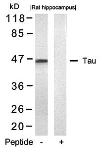 Tau (Ab-422) Antibody