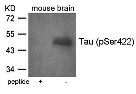 Tau (Phospho-Ser422) Antibody