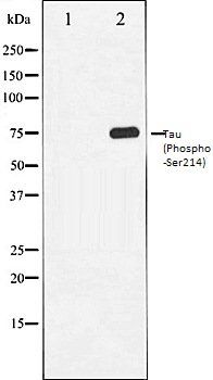 Tau (Phospho-Ser214) antibody