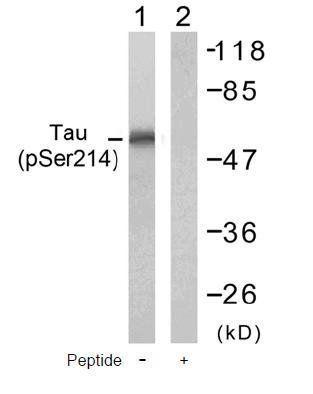 Tau (Phospho-Ser214) Antibody