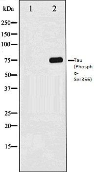 Tau (Phospho-Ser356) antibody