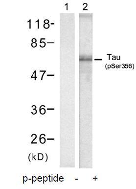Tau (Phospho-Ser356) Antibody