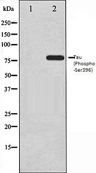 Tau (Phospho-Ser396) antibody