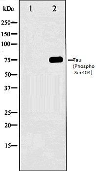 Tau (Phospho-Ser404) antibody