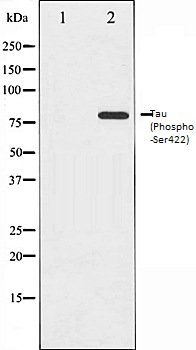Tau (Phospho-Ser422) antibody