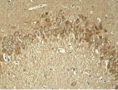 Tau (Phospho-Thr181) Antibody