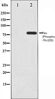 Tau (Phospho-Thr205) antibody