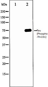 Tau (Phospho-Thr231) antibody
