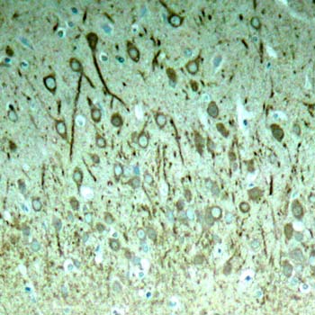 Tau (Phospho-Thr231) Antibody