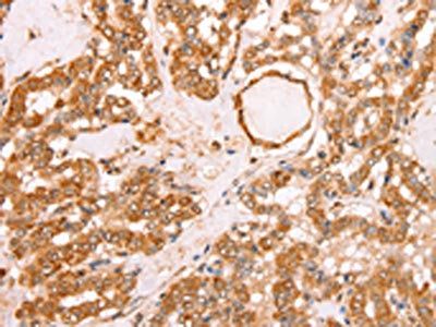 TAX1BP1 Antibody