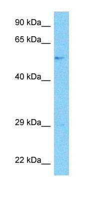 TBB4A antibody