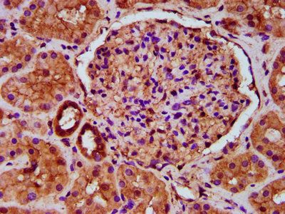 TBC1D1 Antibody