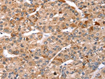 TBC1D1 antibody