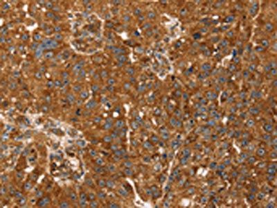 TBC1D1 Antibody