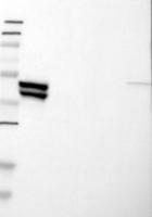 TBC1D13 antibody