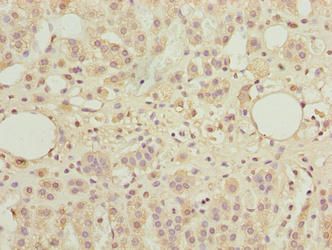 TBC1D14 Antibody