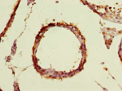 TBC1D19 Antibody