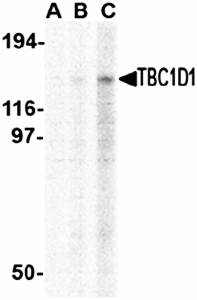 TBC1D1 Antibody