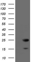 TBC1D21 antibody