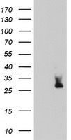 TBC1D21 antibody