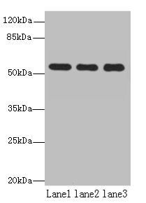 TBC1D22A Antibody