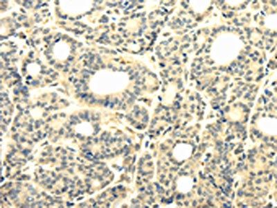 TBC1D22A Antibody