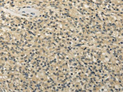 TBC1D22A Antibody