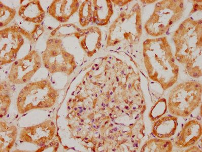 TBC1D23 Antibody