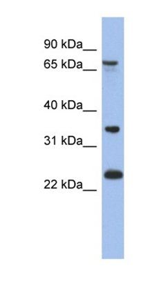TBC1D25 antibody