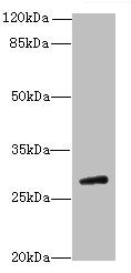 TBC1D26 antibody