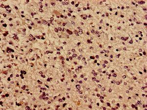 TBC1D31 Antibody