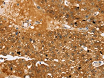 TBC1D4 Antibody