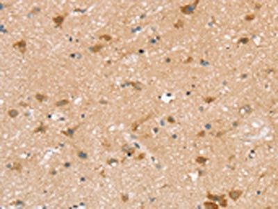 TBC1D4 Antibody