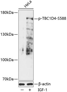 TBC1D4 (Phospho-S588) antibody