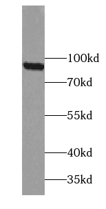 TBC1D5 antibody