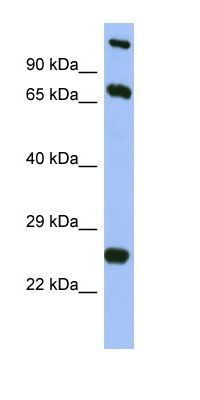 TBC1D7 antibody