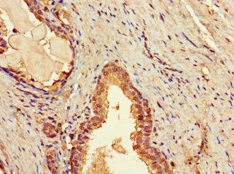 TBC1D7 antibody