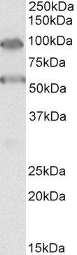 Goat anti-TBC1D9 Antibody