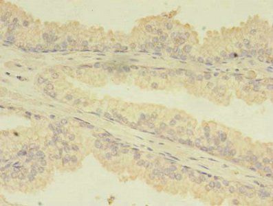 TBCA Antibody